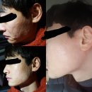 인셀덤블링블링뷰티