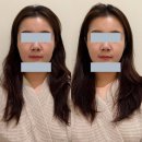 레이킨스약국 | 일산 헤드스파로 리프팅 효과까지 볼 수 있는 리본에스테틱