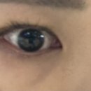 좋은이안과의원 네이버블로그