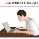 뒷골이 땡기는 이유 뒷머리 통증 : 거북목증후군 긴장성두통 고혈압 후두신경통 뇌종양 이미지