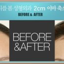 헤어체크 이미지