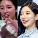 아름다운미소 제로네이트 후기
