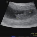 통팔아구 이미지