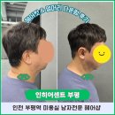 고샘길 | 인천 부평역 미용실 인히어센트 마유빈 디자이너샘의 남자 컷트 &amp; 다운펌 후기