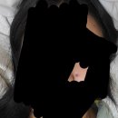 [모낭염] 피부과 처방받으면 나을까?