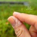 봄봄피부과의원 네이버블로그