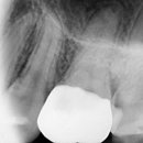 최신심미치과기공소 이미지