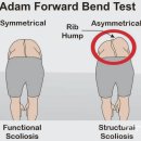 을-090 | [매교역 필라테스] 30대 초음파사 체형교정 후기 흉곽 전방열림 개선 변화｜비포애프터