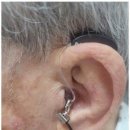 포낙보청기 강동센터 이미지