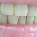 덴탈 케어 시스템 이미지