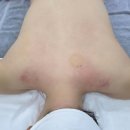 려원피부샵 | 팔뚝인모드 안부러웠던 노원 신부관리, 려원 피부관리 방문 후기