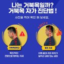수내정형외과 거북목증후군 정확한 진단 받았어요 — 케이튼튼정형외과