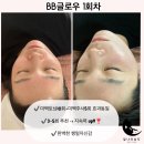 ♥️대폭할인이벤트 [비비글로우 / 샤넬관리/더쎄라링클콕/속눈썹보톡스틴트펌/꽃립 입술반영구] 이미지