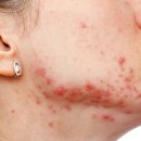 이너메디칼 이미지