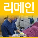 다리튼살 스트레스! 이미지