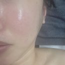 도농로24 | 도농역 피부관리 채원뷰티 겨울철 홍조 잡는 CO2 카복시 테라피 리얼 후기 (feat. 물광 피부)