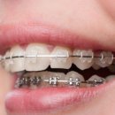 서울하얀치과의원 이미지