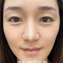 블로즈 이미지