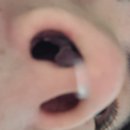 (주)정이메디칼 | [영메디칼] 입벌림방지밴드 &amp; 코골이방지기구로 숙면하다.