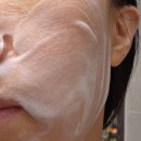 아젤리아 | 아젤리아 여드름 연고 사용법 효과 후기