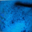 하나의원 | 베러미의원주차 마곡나루피부과 압출후관리 제네시스시술후기