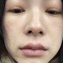 장희빈