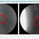 영통단단마디의원 네이버블로그