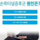 손목터널증후군, 내 손목이 아프다면? 알아보자!