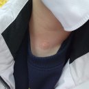 평택핑크리본외과의원 | 평택 핑크리본외과 갑상선 혹 정기검진 기록