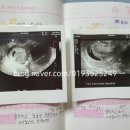 신성건강원 - 군산시 신성1길 19 | 계류유산 소파술 후기 임신중절수술 비용