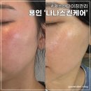 풍덕천로2L | 커스터마이징 관리 일주일 솔직후기 용인수지 &#39;나나스킨케어&#39; #기미 #모공 #탄력 #문제성피부