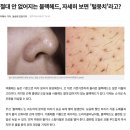 보림약국 | 하남 미사 앙팡에스테틱 후기모공 케어 + 블랙헤드(가시털) 압출 + 그린필까지! 다음엔 흑자 관리