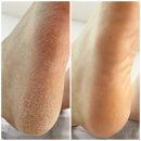 깍고밀고이발 이미지