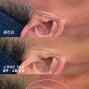 쁘에르 이미지