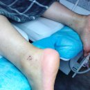 레푸스 앤 쓰담네일 이미지