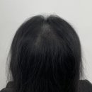 림스칼프 이미지