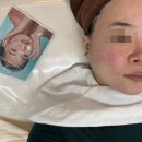 여드름 피부탄력관리 에스테틱 강추 [라움뷰티] 배곧 베니스스퀘어 에스테틱 추천 라움뷰티 후기 가는 길
