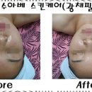 진스킨케어 - 남해군 | 진스킨케어