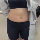 필옵틱스3공장 | 수원 광교 비수술'라인관리전문' 비만클리닉 살빼는법 후기