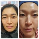 퀸즈인셀덤