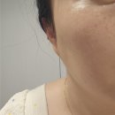 그린메디칼프라자 | 부천신중동피부관리 쏘울터치 방문기! 1:1 맞춤형 피부도로공사 솔직 리뷰