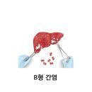 부평점 B 이미지