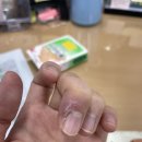 홍피직 우리인삼
