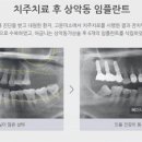 미소가 있는치과의원 이미지