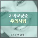 여치과기공소 이미지