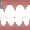 탑플랜트치과의원 이미지