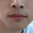 에이치봄의원 이미지