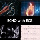 임상병리사 심장초음파 및 기능검사 카페 들어오세요 이미지