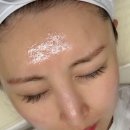 (주)티에스메디칼 | 운정 피부관리｜리틀헤이나 &#34;크라이오 더마 플래닝 + 에어티에스 물광관리&#34;