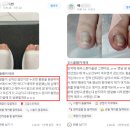 레푸스전주 이미지